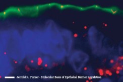 occludin-endocytosis